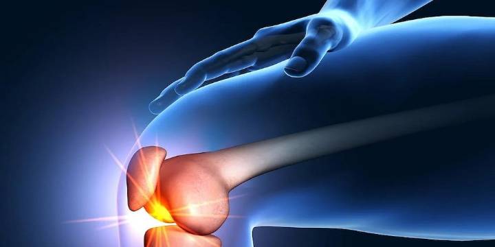 ¿Dolor por artritis de rodilla? La radiación podría ayudar, según un estudio