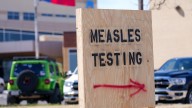 Measles cases in the US continue to rise after already reaching highest count in 30 years