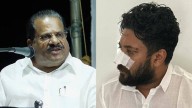 'Only nose injured now, be careful next time'; CPM leader EP Jayarajan takes sly dig at MP Shafi Parambil