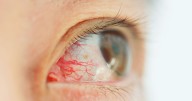 Teen, 19, 'going blind' after parasite enters eye while showering