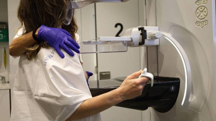 La crisis del cribado del cáncer de mama en Andalucía: faltó sensibilidad pero lo grave es que faltan recursos