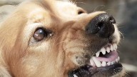 Uttar Pradesh Tragedy: 5-Year-Old Girl Critically Injured After Brutal Stray Dog Attack On Her Way To School In Hapur
