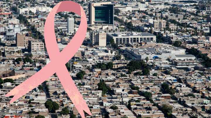 Cáncer de mama en La Laguna cobra una vida cada tres días