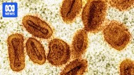 Why mpox cases in Australia in 2025 are a fraction of what they were last year