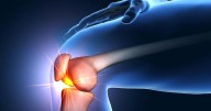 Knee Arthritis Pain? Radiation Might Help, Study Says