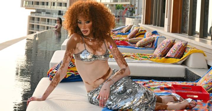 Winnie Harlow Steals the Spotlight in Bra Top & Skirt Look