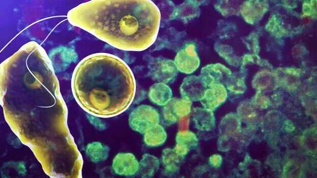 Amoebic meningoencephalitis: Health Dept launches detailled study to identify sources of disease; no environmental specialists in team