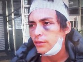 UN JOVEN RECIBIÓ UNA FEROZ GOLPIZA PROPINADA POR SUS PROPIOS FAMILIARES