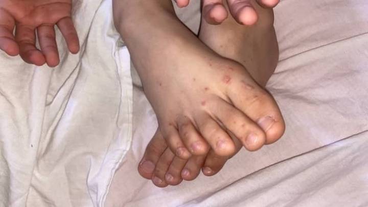 Padres alarmados por el brote de un virus en una escuela de Pocito