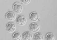 Científicos logran crear óvulos humanos a partir de células de la piel, en un avance sin precedentes