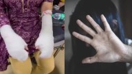 Delhi Police Probe Reveals Acid Attack May Have Been Fabricated India News