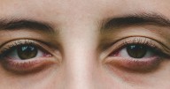 ¿Puedes cambiar el color de tus ojos con operación? Qué es la queratopigmentación y por qué no se recomienda