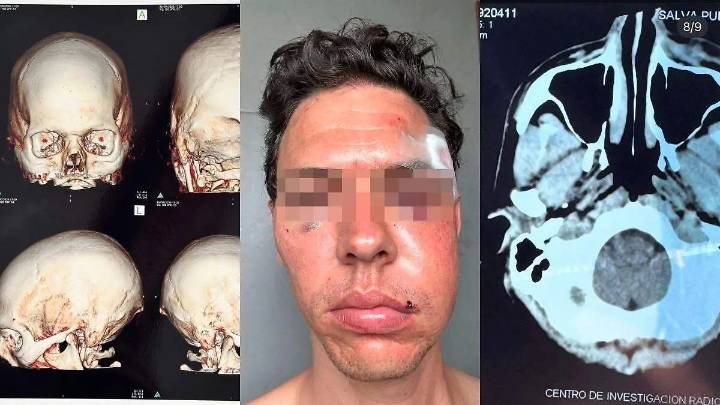 Termina dueño de taller automotriz en Puebla en el hospital tras reacción violenta de cliente