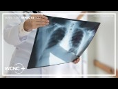 Novant Health shares safety tips after tuberculosis case found at North Mecklenburg high school