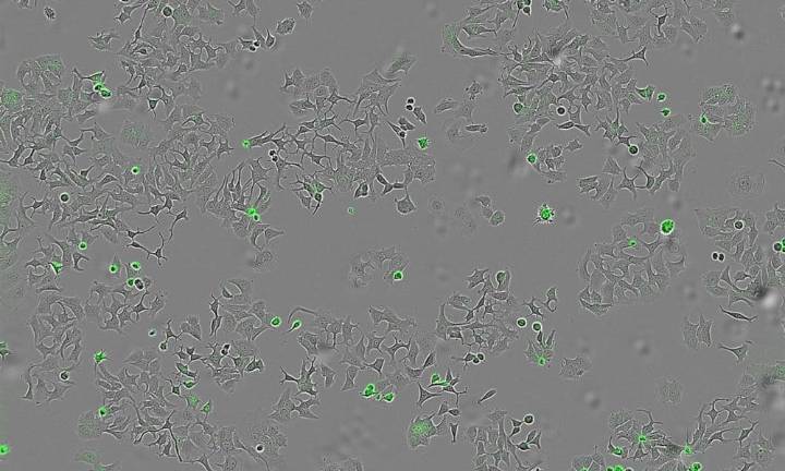 Descubren un mecanismo bacteriano que podría destruir células tumorales