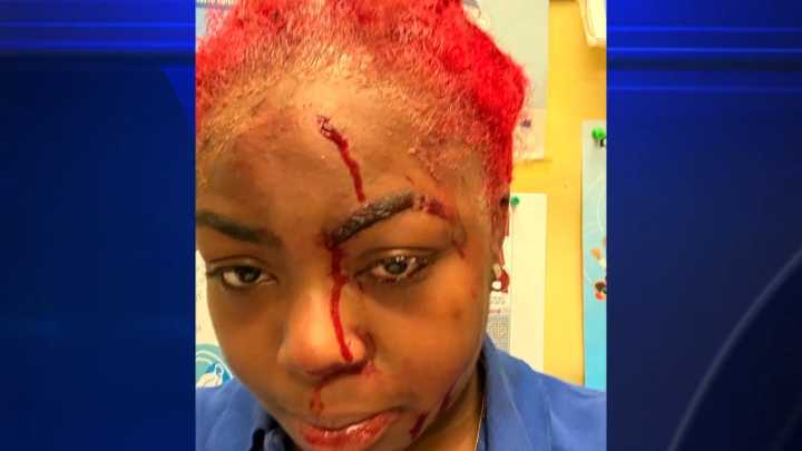 Teen beaten bloody after fight breaks out in Miami Northwestern Senior High bathroom; 1 arrested