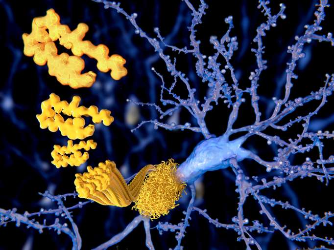 Alzheon's Oral Alzheimer's Drug Shows Safety and Promise for APOE4/4