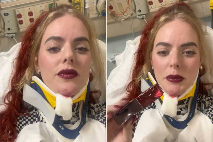 Woman's Lipstick Remains 'Flawless' Even After a Bicycle Accident (Exclusive)