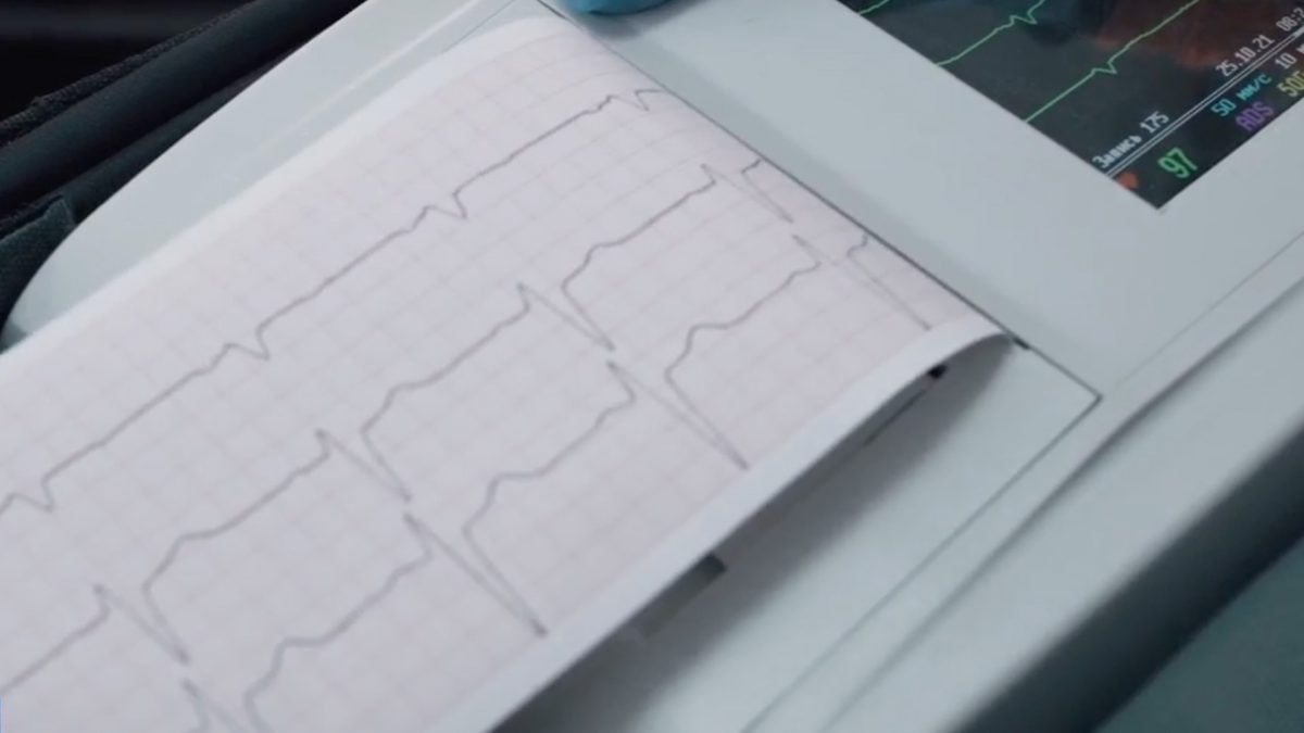 Advierten por “corazón frágil”; aumentan infartos en personas jóvenes de Coahuila