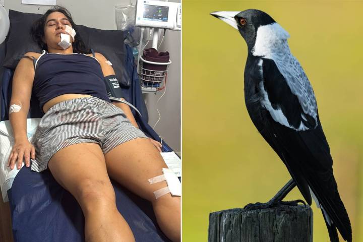 Magpie Attacks Woman Working Abroad, Leaving Her with a Broken Neck: Photo