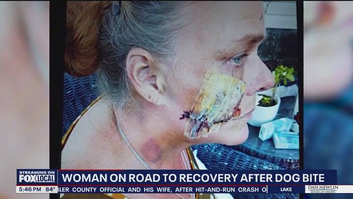 Caregiver recovering after dog mauling in Cocoa