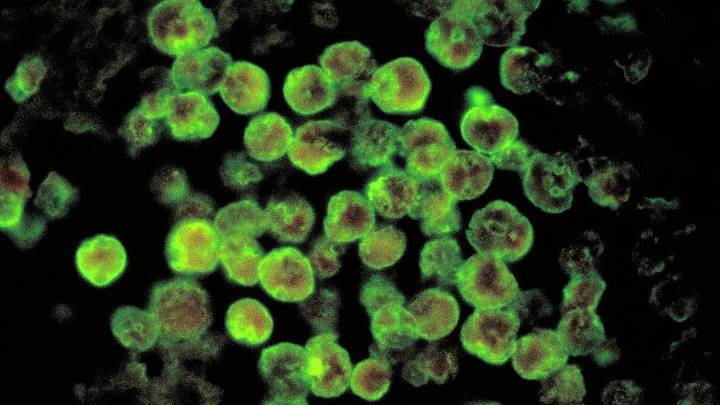 Amoebic infection confirmed in three-year-old boy in Kerala’s Kannur