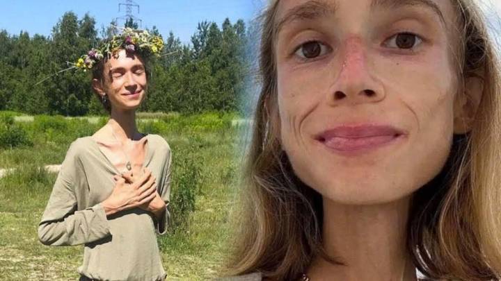 Muere mujer de 27 años que comía solo frutas y pesaba 22 kilos; ¿qué le pasó?