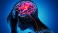 World Stroke Day: Reminding urgency in recognising, preventing life