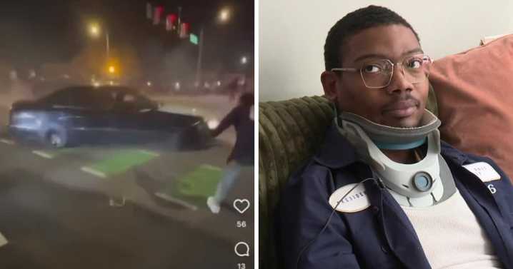 Man seriously injured in Richmond street takeover speaks out