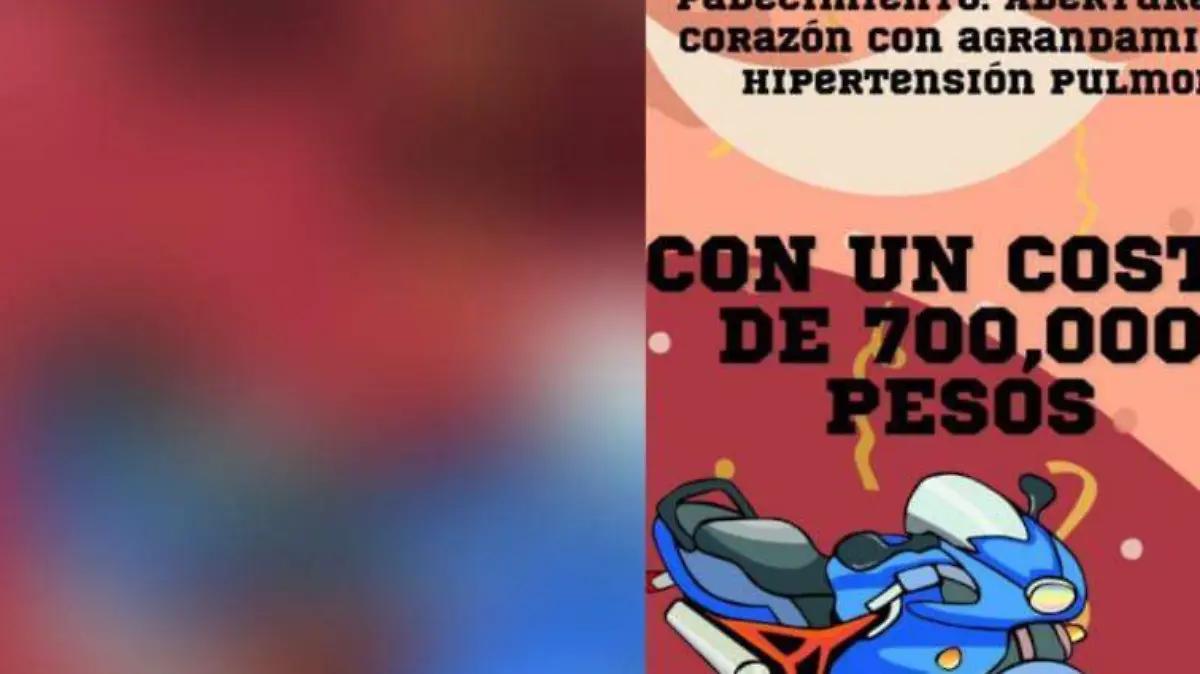 Organizan elementos del Grupo Táctico de Proximidad evento para Axel; requiere intervención a corazón abierto