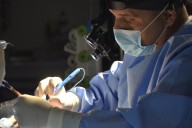 Rinoplastia con tecnología ultrasónica: salud y estética en un mismo procedimiento