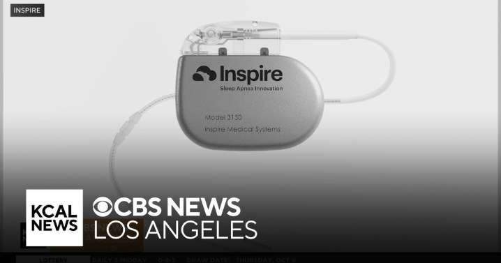 Groundbreaking sleep apnea treatment helping children with down syndrome get help they need