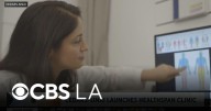 Doctor discusses new Cedars-Sinai clinic focused on fitness, health and aging