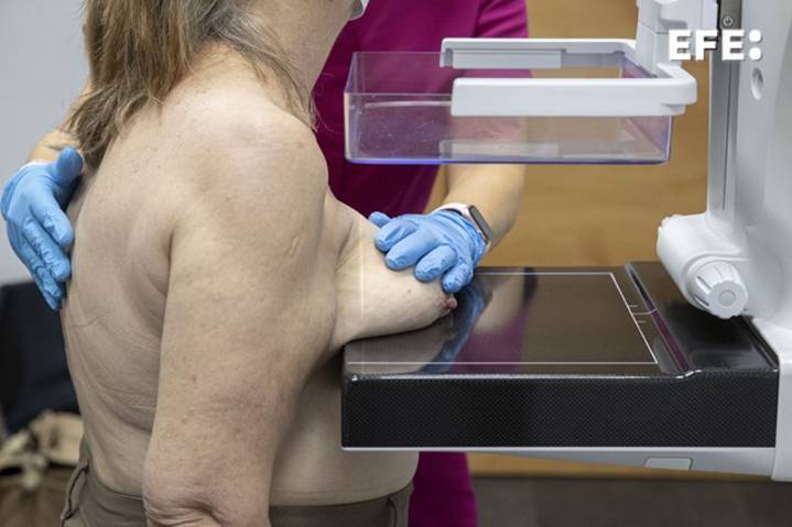 La Generalitat se compromete a dar el resultado de una mamografía en 30 días máximo tras la prueba