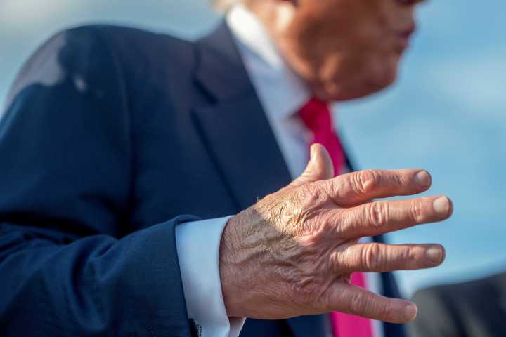'They’re ripping my hand up': Trump gripes that handshakes are hurting