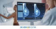 Cáncer de mama: cambian la edad en la que se debe hacer la primera mamografía
