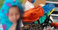 Bebé Jazlyn recibe injertos con éxito y comienza terapia física en hospital de Texas