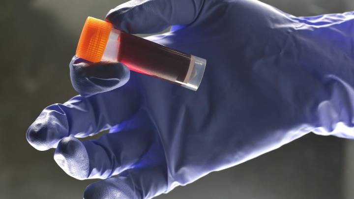Descubren un nuevo anticuerpo eficaz contra el VIH: “el virus queda bloqueado y ya no puede infectar la célula objetivo”