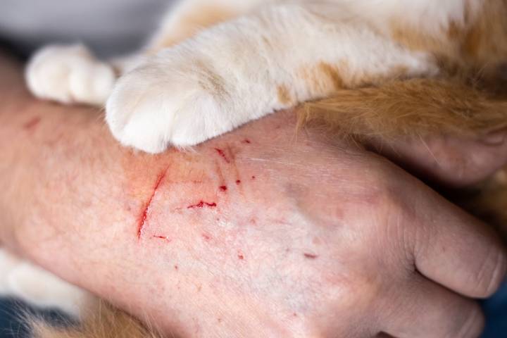 Stray Cat with Rabies Mauled Elderly Couple in New Jersey