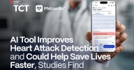 AI-Powered Electrocardiogram Improves Heart Attack Detection and Could Help Save Lives Faster, Studies Find