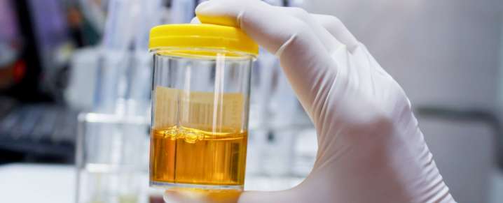 Something in Your Pee Could Predict Your Risk of One Kind of Dementia