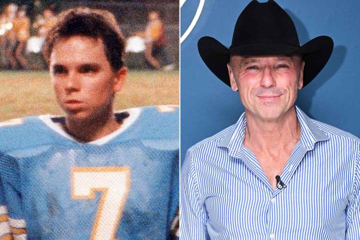 Kenny Chesney on Losing His Hair at 19 — and Why He's Grateful Now (Exclusive)