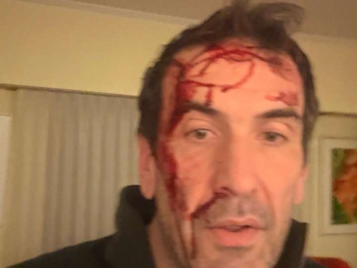 Asaltaron y golpearon a Pablo Cervi, candidato libertario en Neuquén, a horas de las elecciones