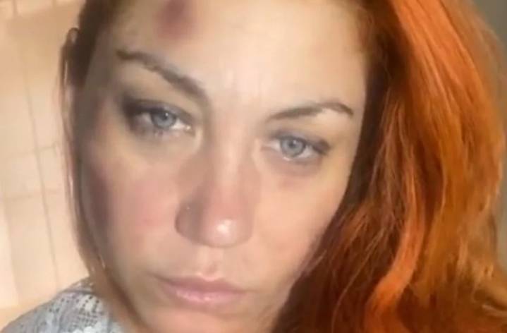 Lourdes Fernández denunció a su pareja en 2022 y dejó una frase que conmovió: “El amor no duele”