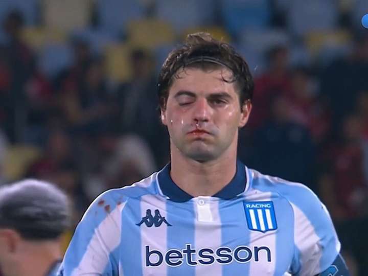 Santiago Sosa quedó con el ojo como un boxeador por un codazo de Marcos Rojo en la semifinal de la Libertadores de Flamengo vs Racing