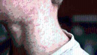 Measles outbreak in South Carolina grows: health officials still searching for source