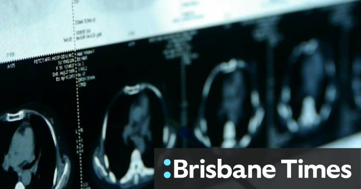 Breastfeeding helps reduce breast cancer, scientists find