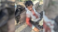 Dos perros pitbull atacaron brutalmente a un hombre que entraba a trabajar