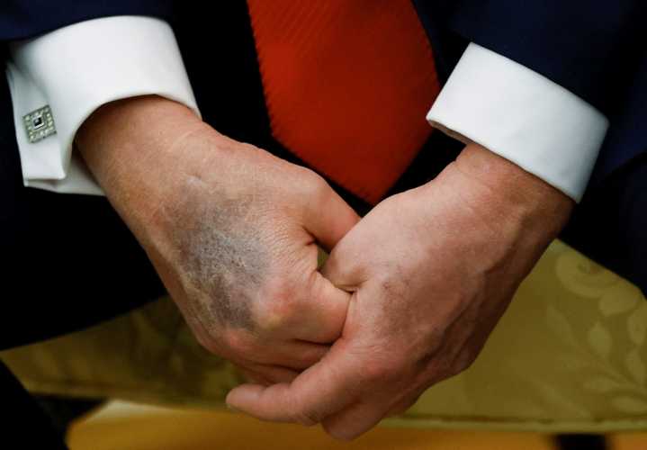'Not routine': Medical expert wonders what was 'deliberately left out' of Trump MRI disclosure