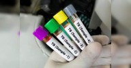 India's TB fight gets a boost: New Made-in-India diagnostic tests cut cost & time